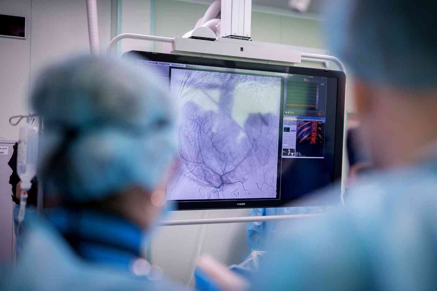 radioembolization liver tumors, liver cancer targeted therapy, liver metastases treatment, Russian-made radiopharmaceuticals, National Medical Research Center Radiology, advanced oncology liver care, radioembolization procedure, minimally invasive liver treatment, liver tumor control therapy, personalized liver cancer treatment, liver tumor microsphere therapy, oncology radiopharmaceutical treatment, targeted liver therapy Russia, liver cancer clinical procedure, radioembolization patient care, liver metastases management, liver cancer treatment innovation, microsphere therapy liver, advanced liver oncology technology, targeted radiotherapy liver tumors, liver cancer hospital procedure, radioembolization clinical setup, liver tumor precision treatment, oncology patient liver therapy, radioembolization medical equipment, liver cancer treatment results, advanced liver cancer intervention, targeted liver microspheres, radioembolization patient monitoring, liver tumor treatment room, Russian liver cancer therapy, radioembolization oncology workflow, minimally invasive oncology procedure, liver metastases precision therapy, advanced liver tumor management, radiopharmaceutical liver treatment, liver cancer treatment clinic, radioembolization hospital interior, liver tumor therapy device, oncology targeted liver treatment, liver microsphere procedure, liver cancer therapy session, radioembolization effectiveness, advanced liver cancer solutions, personalized oncology liver care, radioembolization technology room, liver metastases patient treatment, liver cancer therapy precision, radioembolization clinical outcomes, advanced liver treatment center, minimally invasive liver oncology, liver tumor therapy process, radioembolization patient preparation, oncology liver microsphere therapy, liver cancer intervention technology, radioembolization procedure hospital, liver tumor care innovation, advanced targeted liver therapy, radioembolization medical procedure, oncology liver cancer workflow, liver metastases treatment innovation, radioembolization clinical results, advanced radiopharmaceutical liver treatment, liver tumor precision oncology, radioembolization procedure effectiveness, targeted liver cancer management, advanced oncology liver therapy, radioembolization hospital technology,